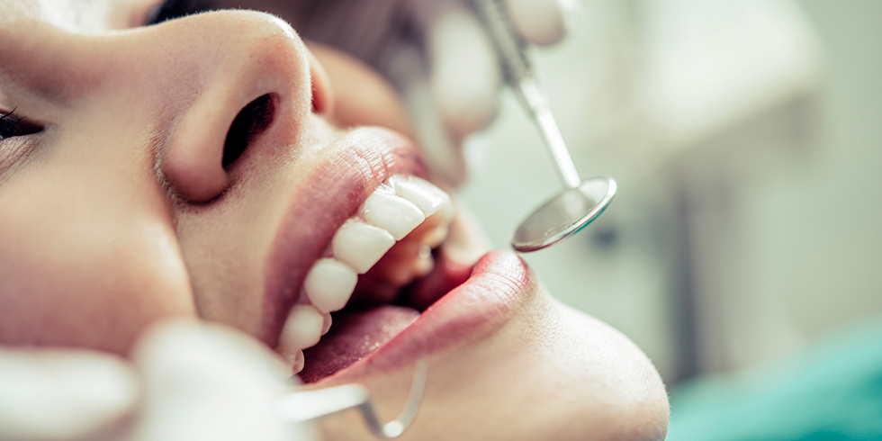 Por que é importante realizar limpeza dentária periodicamente?