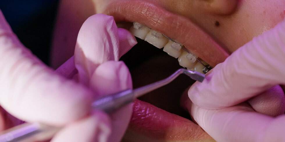 Qual a diferença entre Ortodontia preventiva e Ortodontia corretiva?