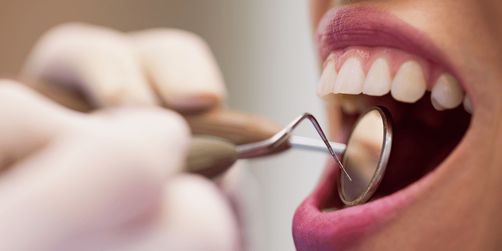 Lente de Contato Dental Danifica o Esmalte dos Dentes?