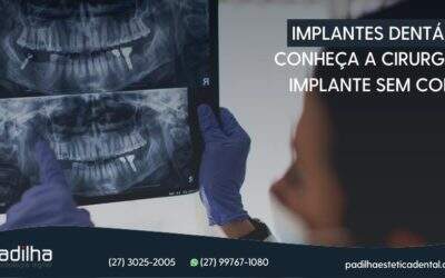 Implantes Dentários: Conheça a cirurgia de implante sem cortes!