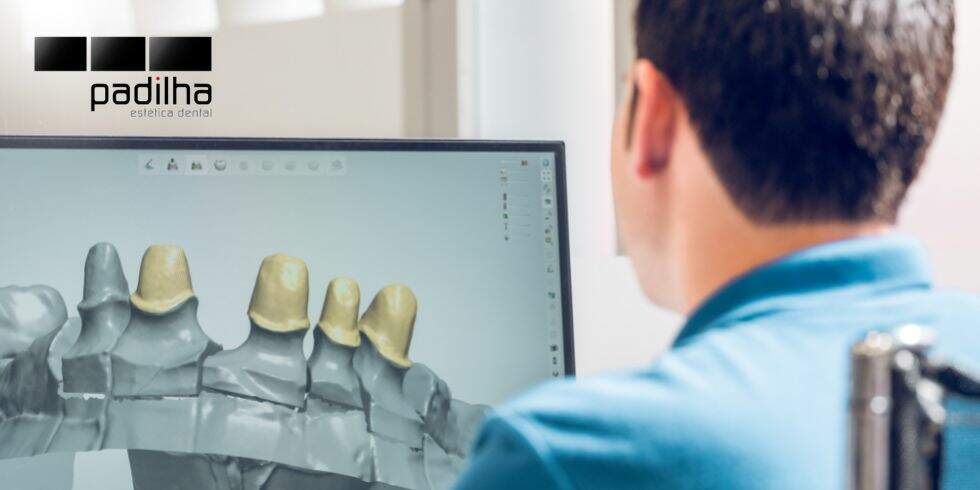 Próteses Dentárias | O Que é Implante Guiado no Computador?