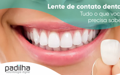 Lente de Contato Dental | Tudo o Que Você Precisa Saber