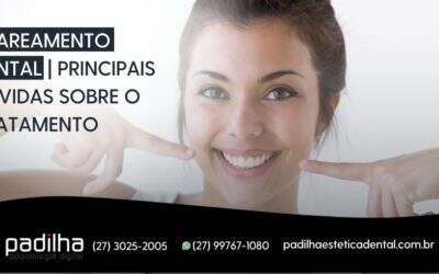 Clareamento Dental | Principais Dúvidas Sobre o Tratamento