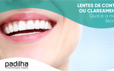 Lentes de contato dental ou clareamento? Qual é a melhor técnica?