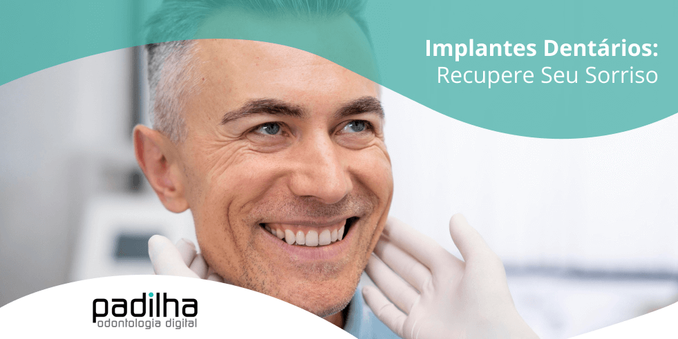 Implantes Dentários: Recupere Seu Sorriso com Tratamentos Ideais
