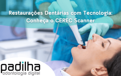 Restaurações Dentárias com Tecnologia: Conheça o CEREC Scanner