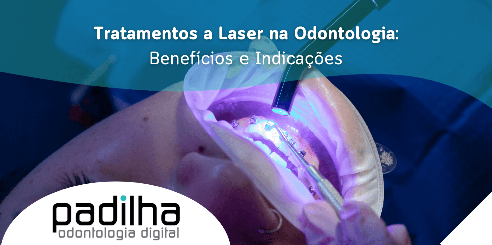 Tratamentos a Laser na Odontologia: Benefícios e Indicações