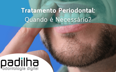 Tratamento Periodontal: Quando É Necessário?
