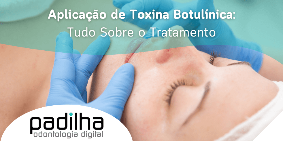 Aplicação de Toxina Botulínica: Tudo Sobre o Tratamento