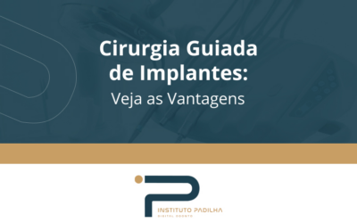 Cirurgia Guiada de Implantes: Veja as Vantagens