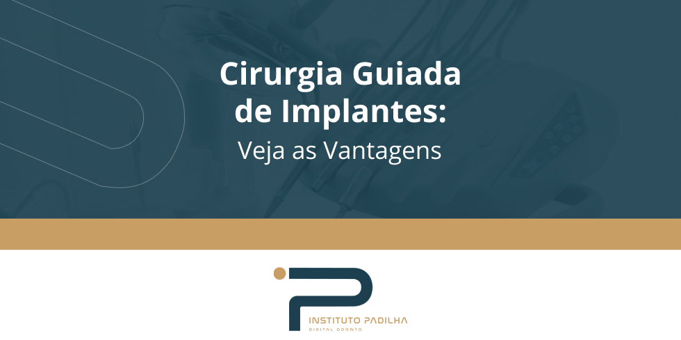 Cirurgia Guiada de Implantes: Veja as Vantagens
