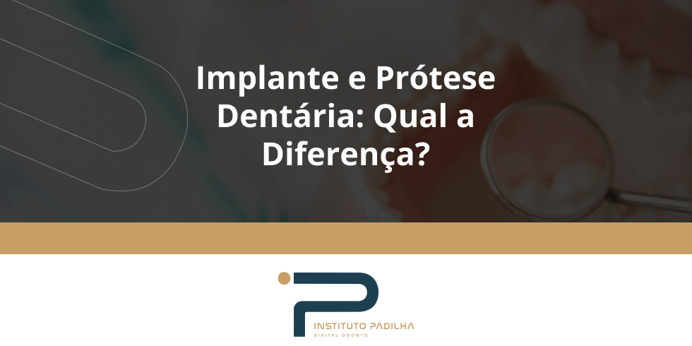 Implante e Prótese Dentária: Qual a Diferença?